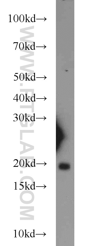 Western Blot (WB) analysis of mouse heart tissue using BUD31 Polyclonal antibody (11798-1-AP)