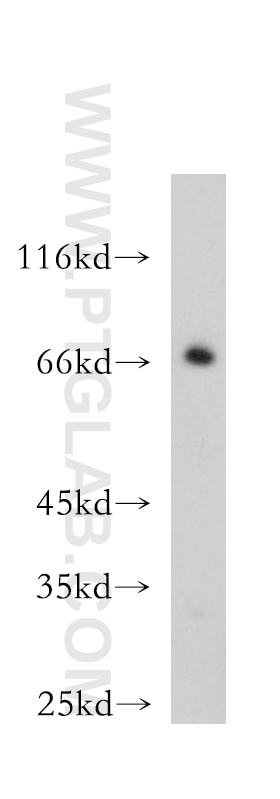 Western Blot (WB) analysis of mouse skeletal muscle tissue using BVES Polyclonal antibody (12920-1-AP)