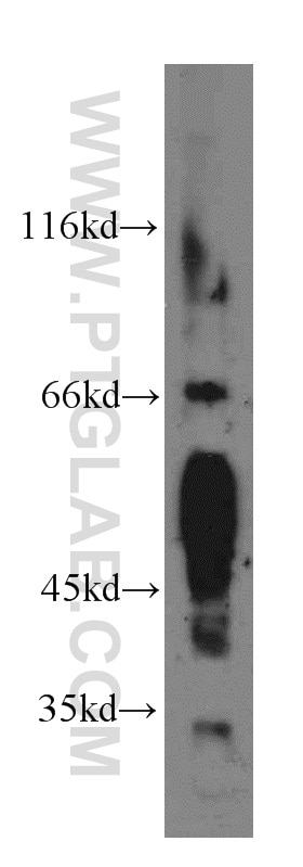 Western Blot (WB) analysis of mouse skeletal muscle tissue using BVES Polyclonal antibody (12920-1-AP)