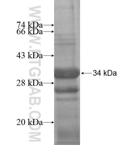 BVES fusion protein Ag14601 SDS-PAGE