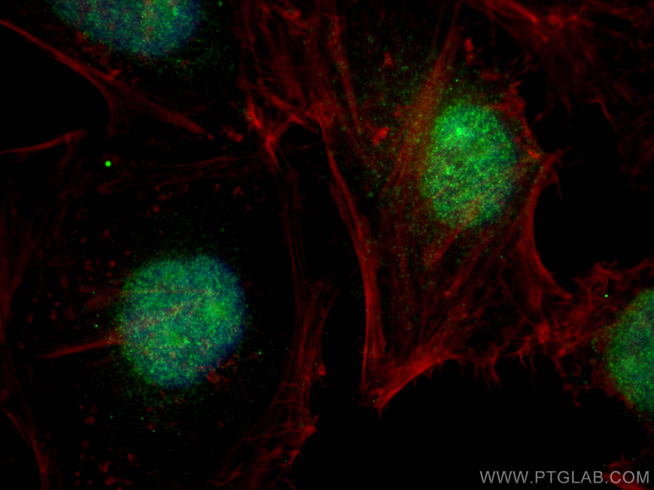 Immunofluorescence (IF) / fluorescent staining of HeLa cells using BXDC1 Polyclonal antibody (17584-1-AP)