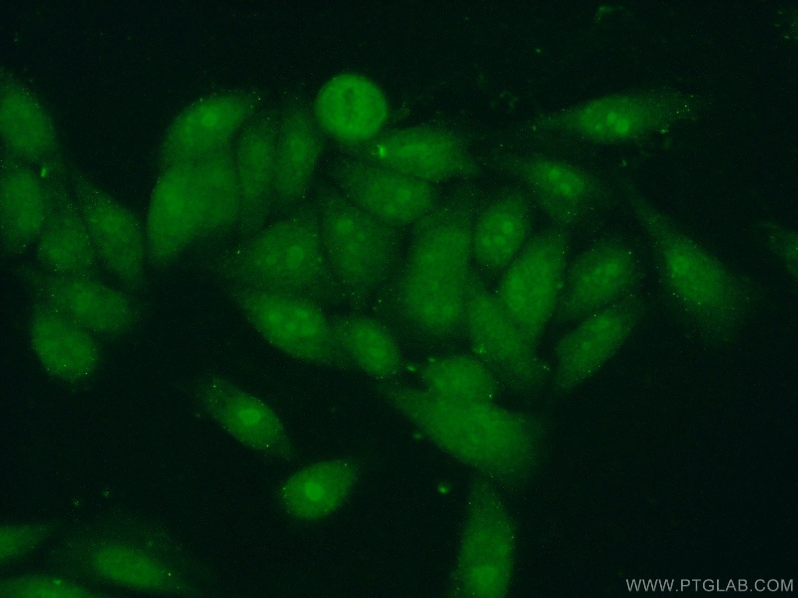 Immunofluorescence (IF) / fluorescent staining of HeLa cells using BXDC1 Polyclonal antibody (17584-1-AP)