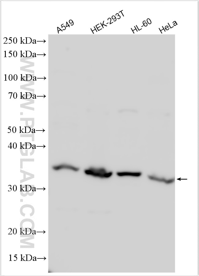 Western Blot (WB) analysis of various lysates using BXDC1 Polyclonal antibody (17584-1-AP)