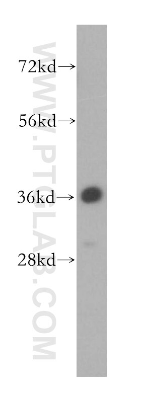 Western Blot (WB) analysis of HeLa cells using BXDC1 Polyclonal antibody (17584-1-AP)