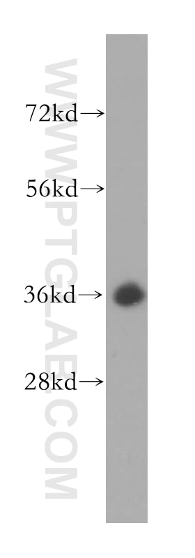 Western Blot (WB) analysis of HL-60 cells using BXDC1 Polyclonal antibody (17584-1-AP)