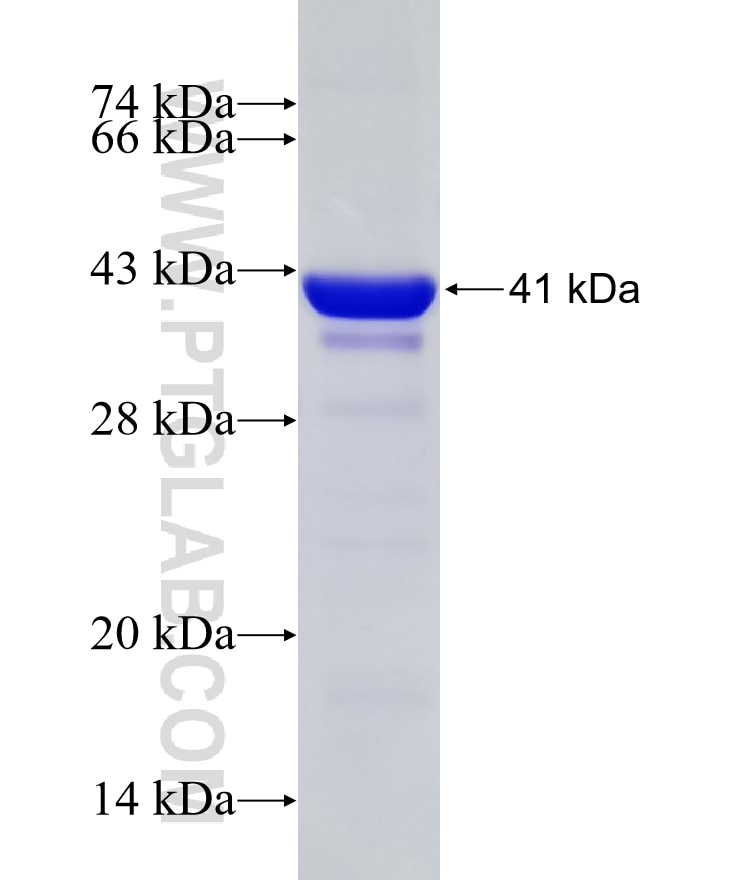 BXDC1 fusion protein Ag11268 SDS-PAGE