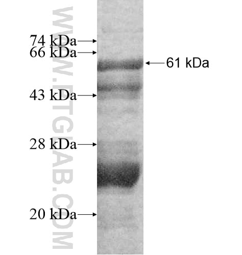 BXDC1 fusion protein Ag11522 SDS-PAGE