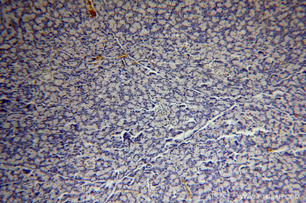 Immunohistochemistry (IHC) staining of human pancreas tissue using BXDC2 Polyclonal antibody (17295-1-AP)
