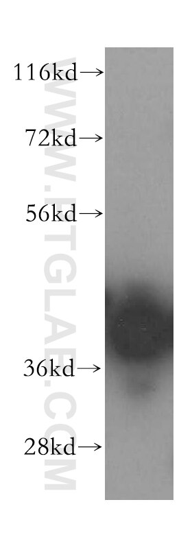 Western Blot (WB) analysis of HeLa cells using BXDC2 Polyclonal antibody (17295-1-AP)