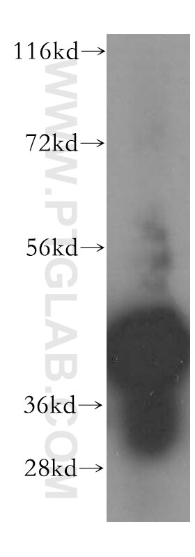 WB analysis of HEK-293 using 17295-1-AP