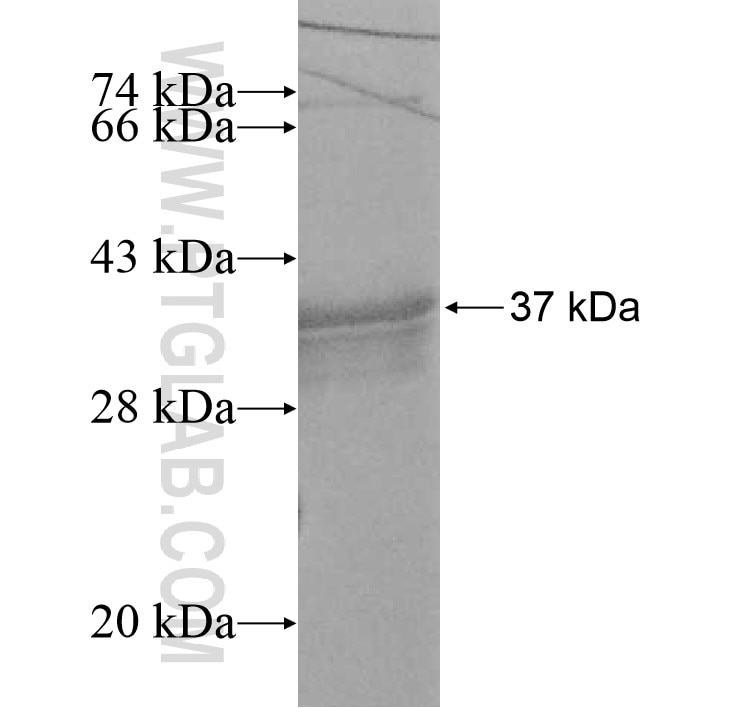 BXDC2 fusion protein Ag11174 SDS-PAGE
