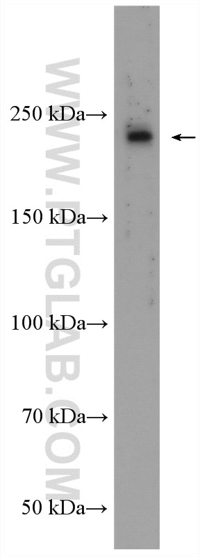 Western Blot (WB) analysis of Neuro-2a cells using BZRAP1 Polyclonal antibody (28241-1-AP)
