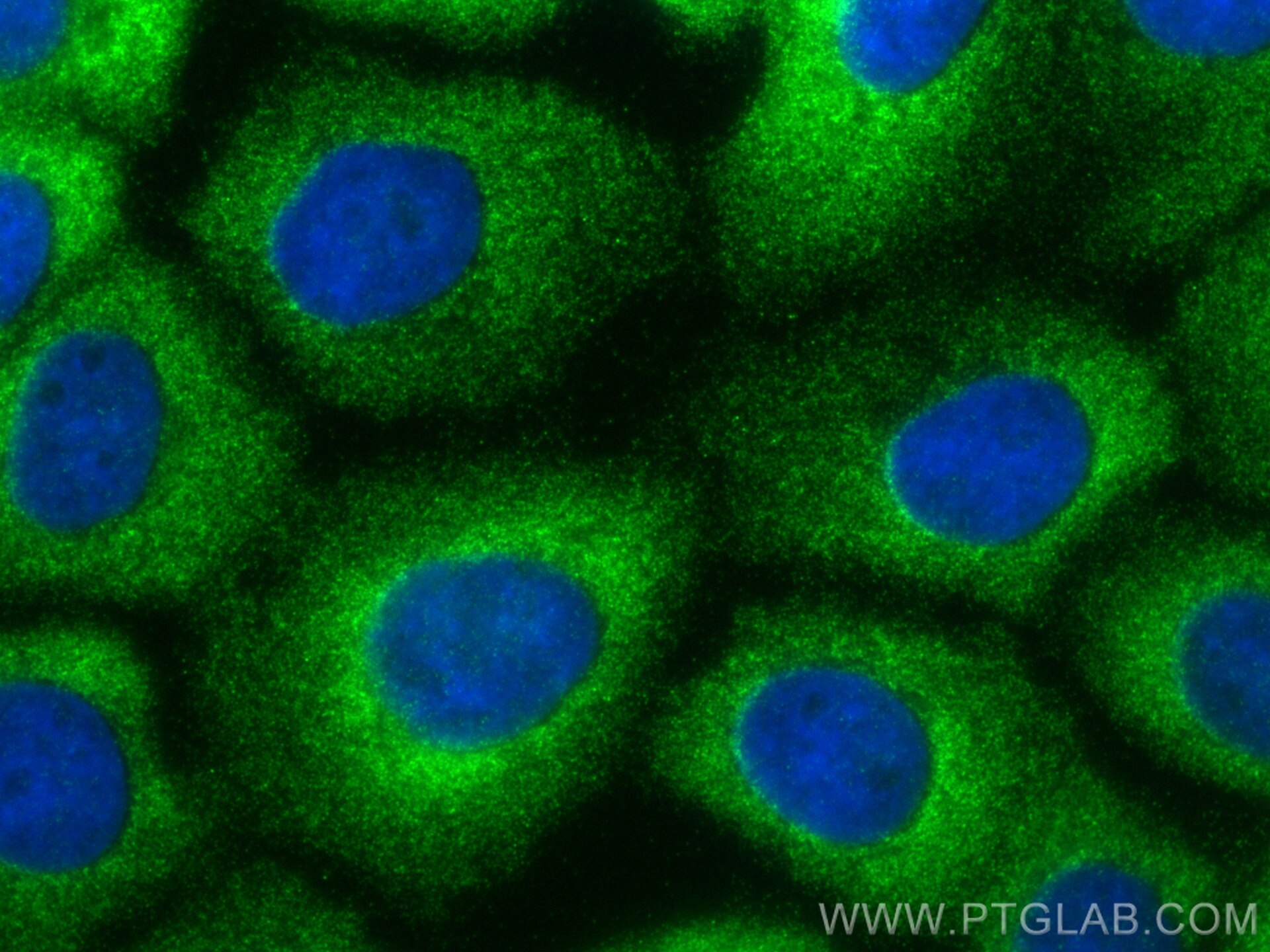 Immunofluorescence (IF) / fluorescent staining of A431 cells using BZW1 Polyclonal antibody (19917-1-AP)