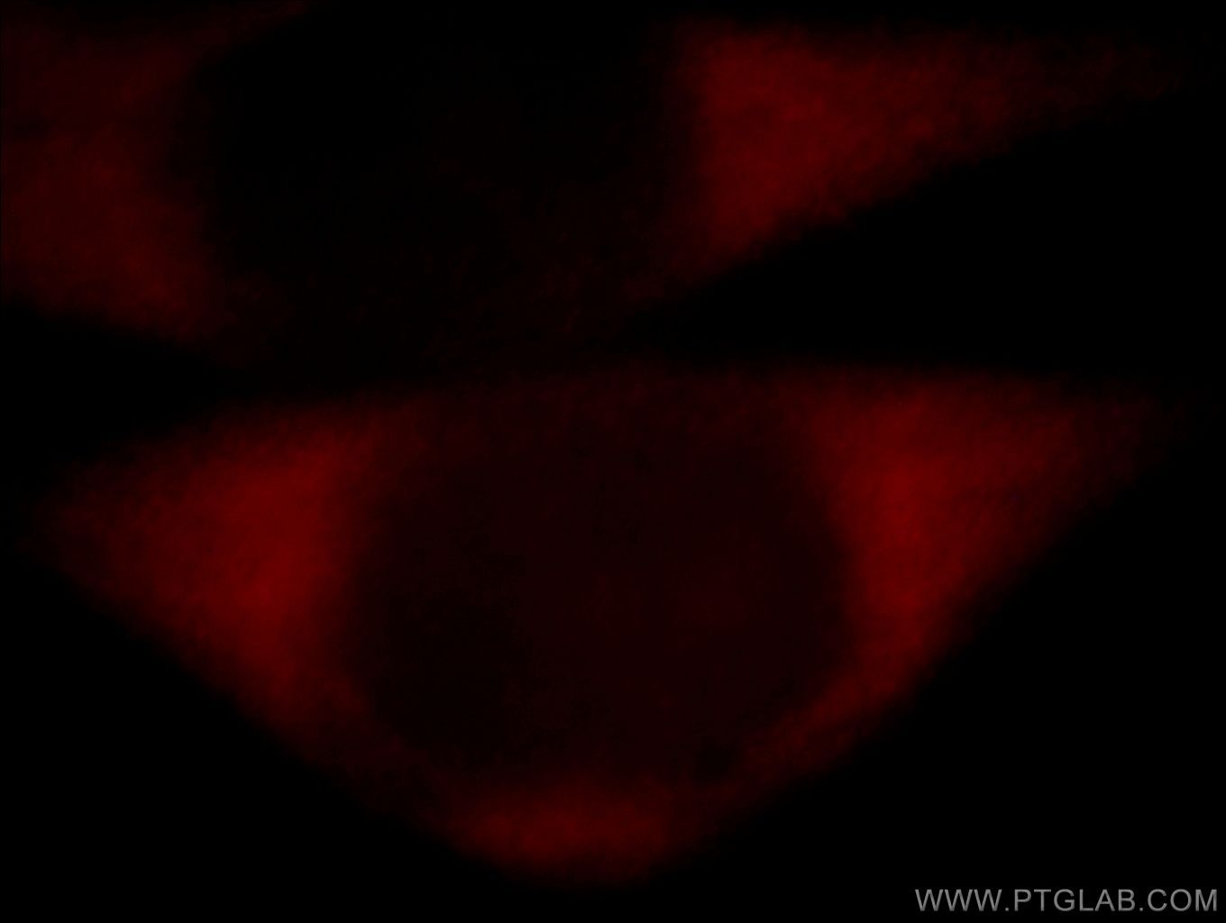 Immunofluorescence (IF) / fluorescent staining of HeLa cells using BZW1 Polyclonal antibody (19917-1-AP)