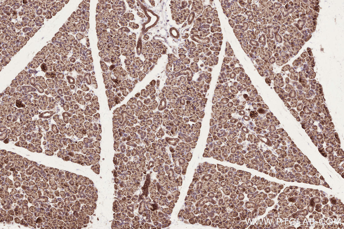 Immunohistochemistry (IHC) staining of mouse salivary gland tissue using BZW1 Polyclonal antibody (19917-1-AP)