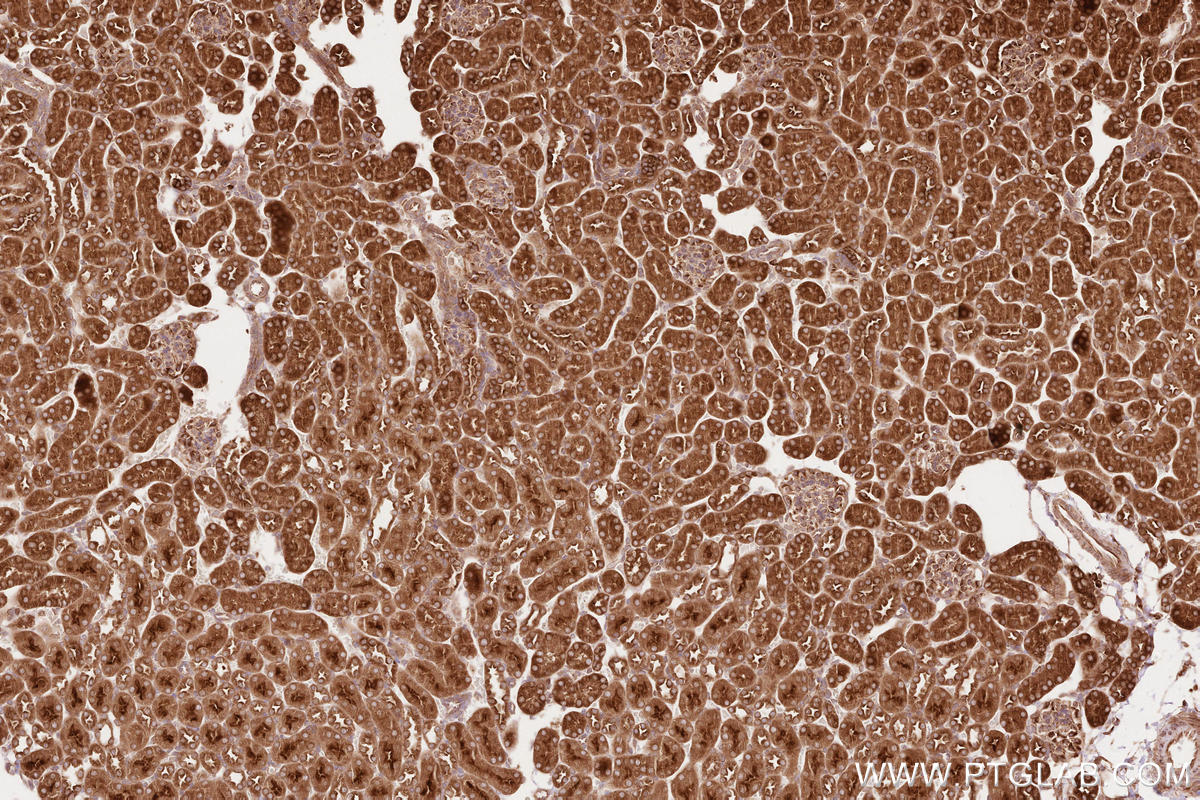 Immunohistochemistry (IHC) staining of mouse kidney tissue using BZW1 Polyclonal antibody (19917-1-AP)
