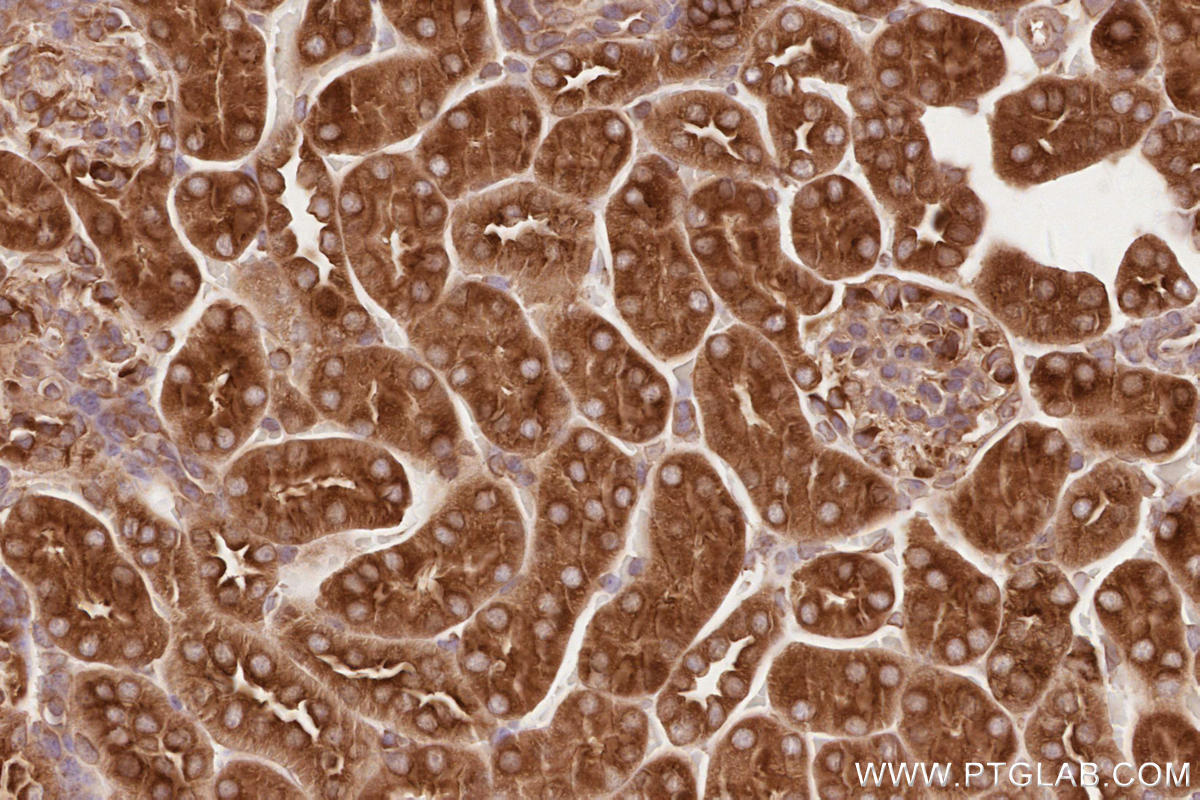 Immunohistochemistry (IHC) staining of mouse kidney tissue using BZW1 Polyclonal antibody (19917-1-AP)