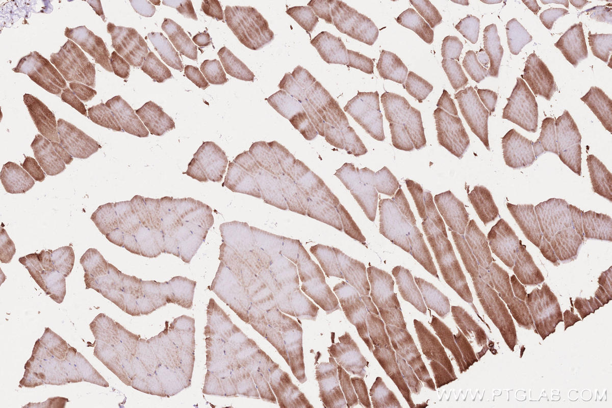 Immunohistochemistry (IHC) staining of mouse skeletal muscle tissue using BZW1 Polyclonal antibody (19917-1-AP)