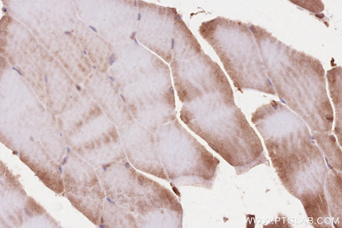 Immunohistochemistry (IHC) staining of mouse skeletal muscle tissue using BZW1 Polyclonal antibody (19917-1-AP)