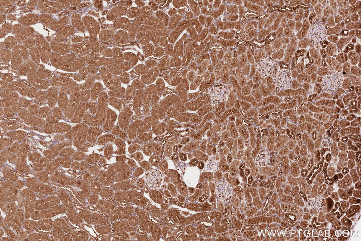 Immunohistochemistry (IHC) staining of rat kidney tissue using BZW1 Polyclonal antibody (19917-1-AP)