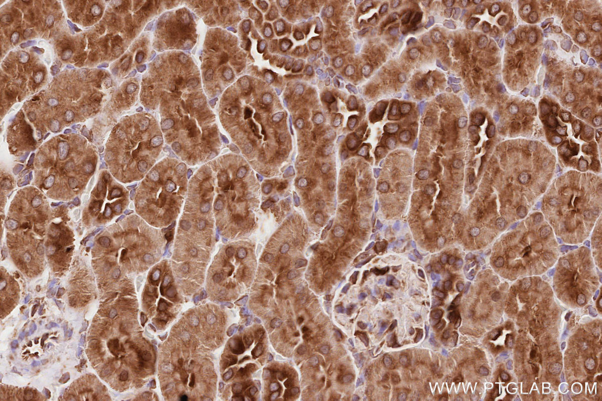 Immunohistochemistry (IHC) staining of rat kidney tissue using BZW1 Polyclonal antibody (19917-1-AP)