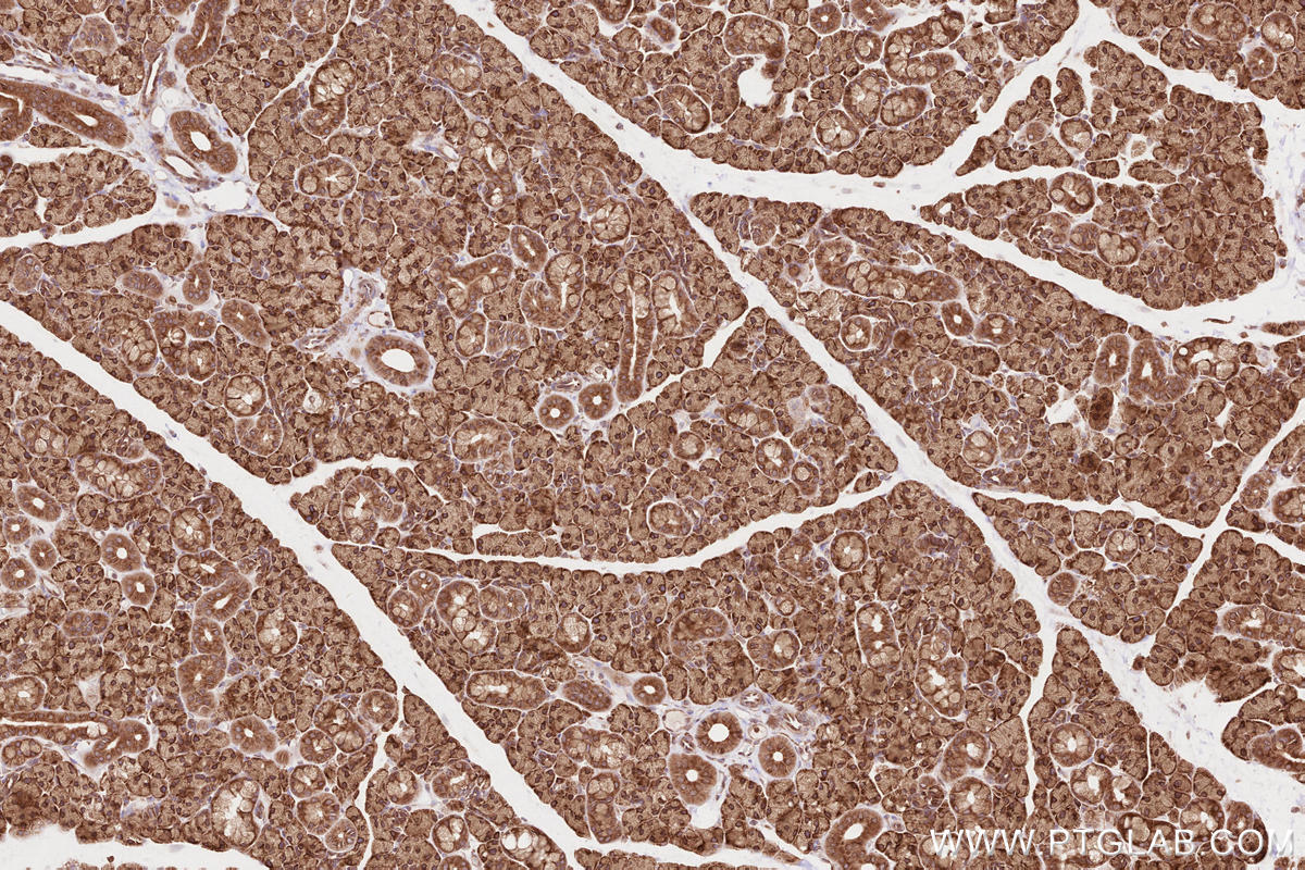 Immunohistochemistry (IHC) staining of rat salivary gland tissue using BZW1 Polyclonal antibody (19917-1-AP)