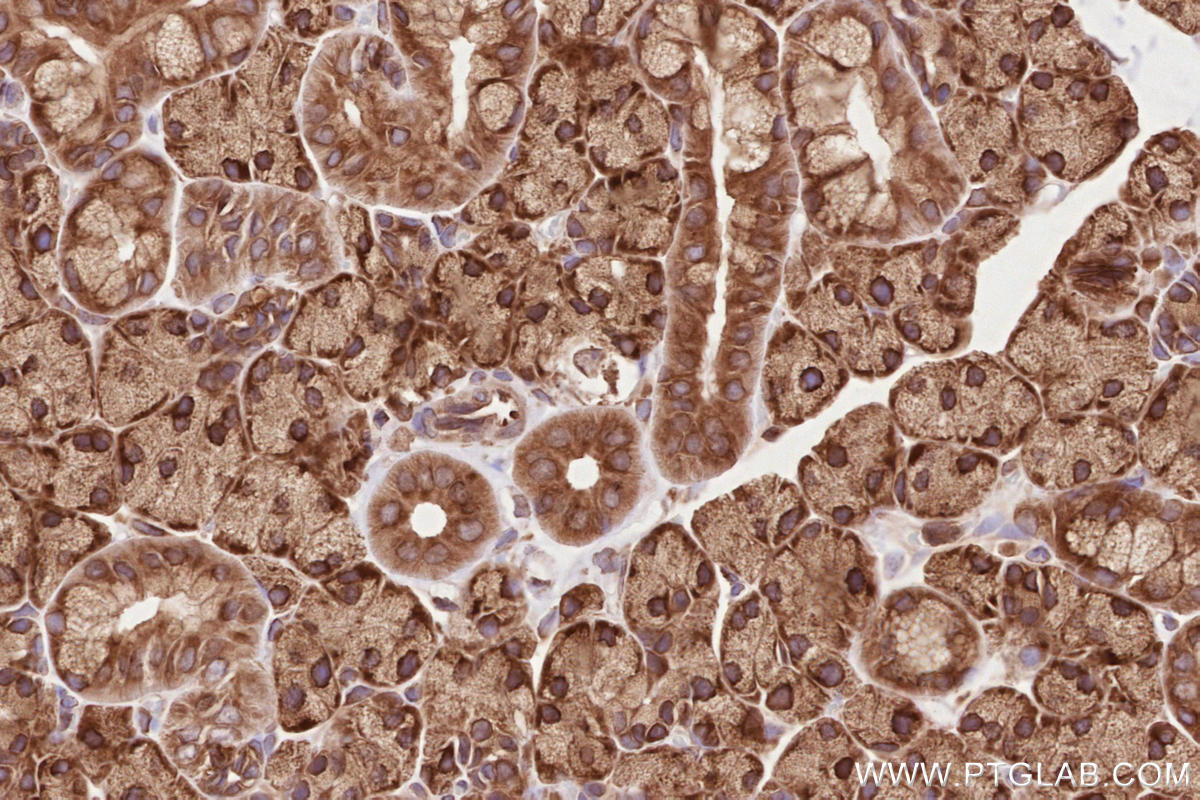 Immunohistochemistry (IHC) staining of rat salivary gland tissue using BZW1 Polyclonal antibody (19917-1-AP)
