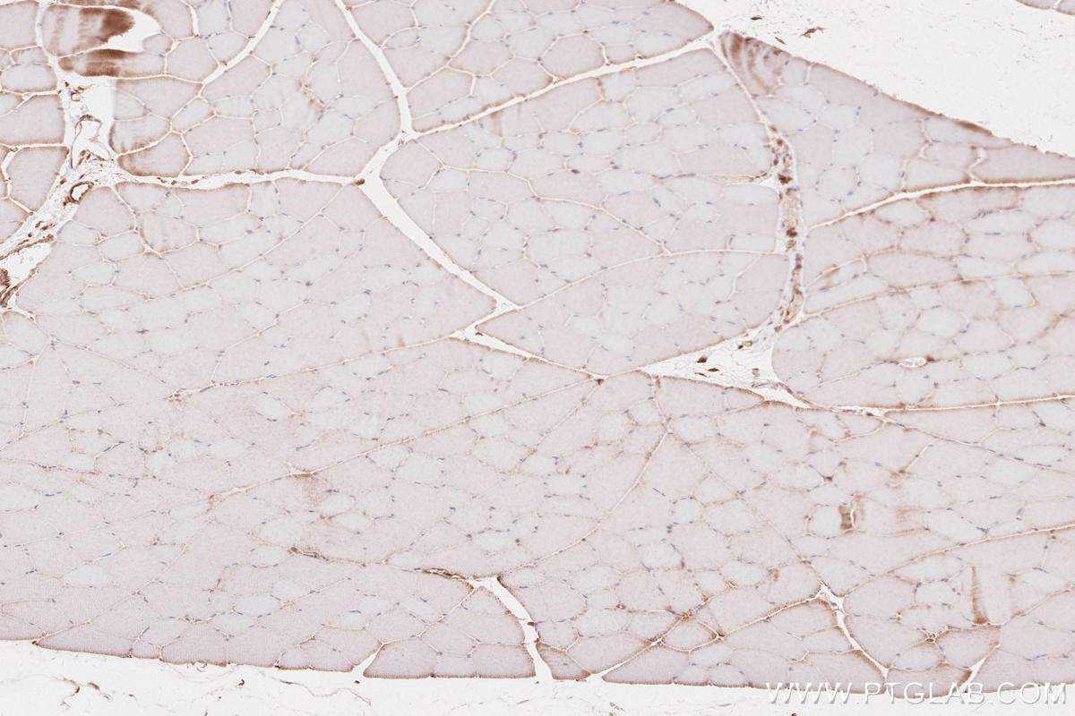 Immunohistochemistry (IHC) staining of rat skeletal muscle tissue using BZW1 Polyclonal antibody (19917-1-AP)
