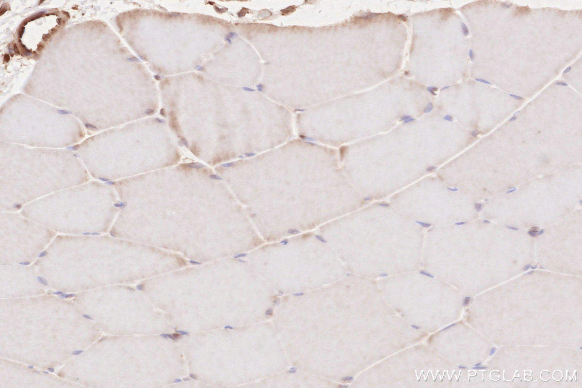 Immunohistochemistry (IHC) staining of rat skeletal muscle tissue using BZW1 Polyclonal antibody (19917-1-AP)