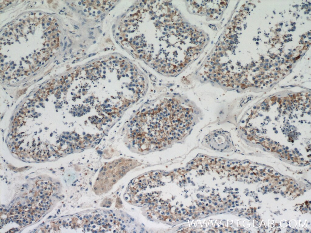 Immunohistochemistry (IHC) staining of human testis tissue using BZW1 Polyclonal antibody (19917-1-AP)