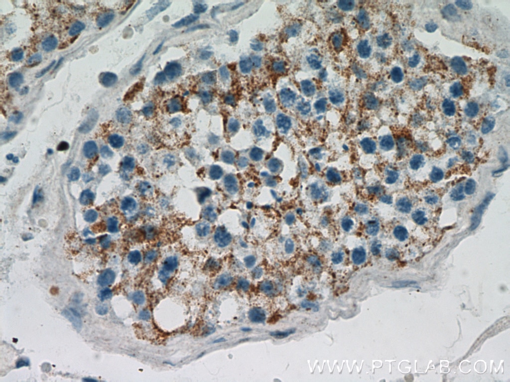 Immunohistochemistry (IHC) staining of human testis tissue using BZW1 Polyclonal antibody (19917-1-AP)