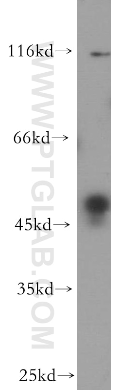 Western Blot (WB) analysis of HeLa cells using BZW1 Polyclonal antibody (19917-1-AP)