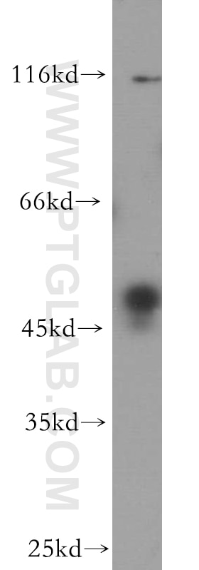 Western Blot (WB) analysis of HeLa cells using BZW1 Polyclonal antibody (19917-1-AP)