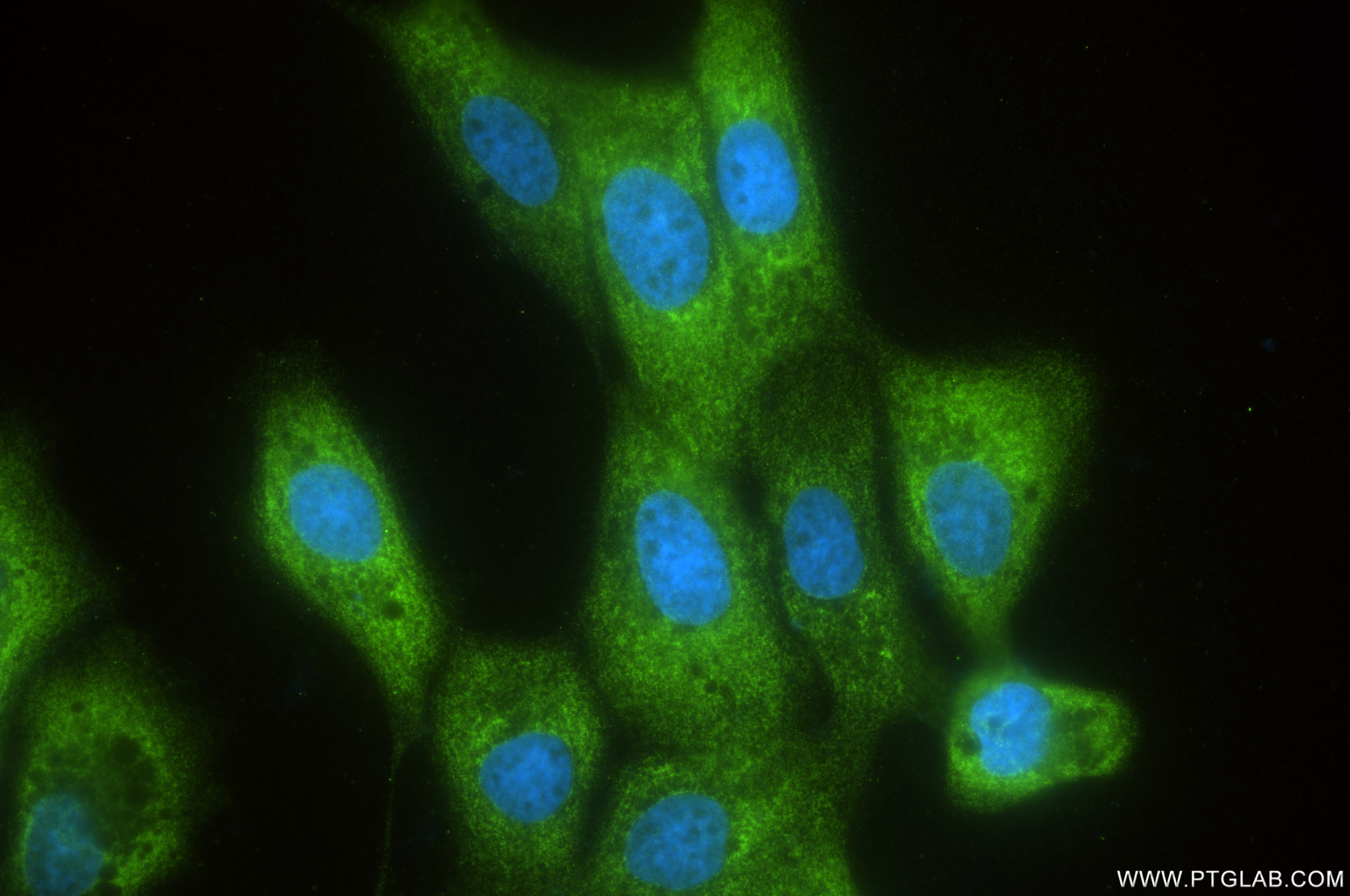 Immunofluorescence (IF) / fluorescent staining of A431 cells using BZW1 Recombinant antibody (85655-1-RR)