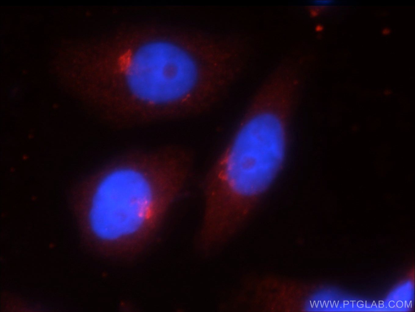 Immunofluorescence (IF) / fluorescent staining of HeLa cells using ATG14/Barkor (C-terminal) Polyclonal antibody (24412-1-AP)
