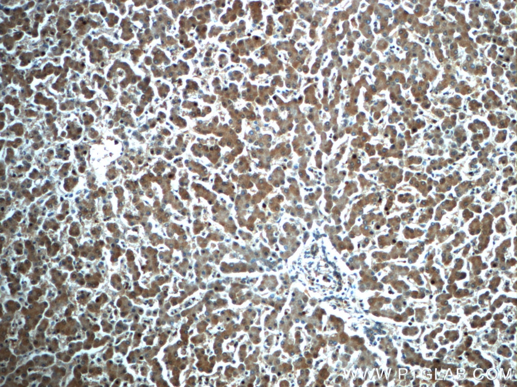 Immunohistochemistry (IHC) staining of human liver tissue using ATG14/Barkor (C-terminal) Polyclonal antibody (24412-1-AP)