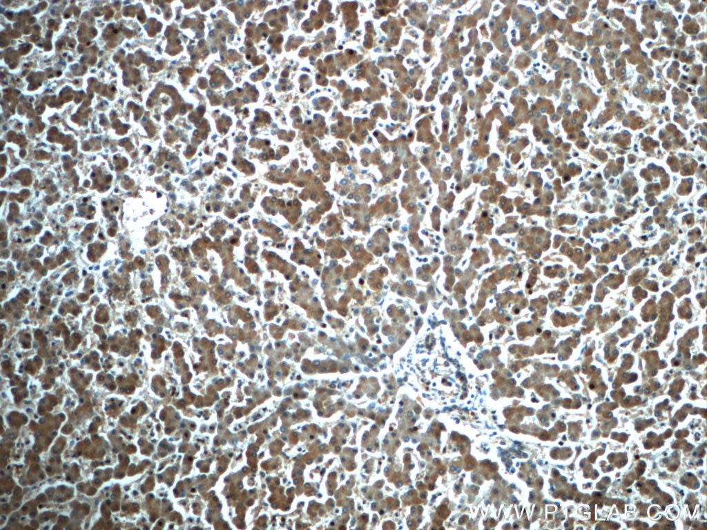 IHC staining of human liver using 24412-1-AP