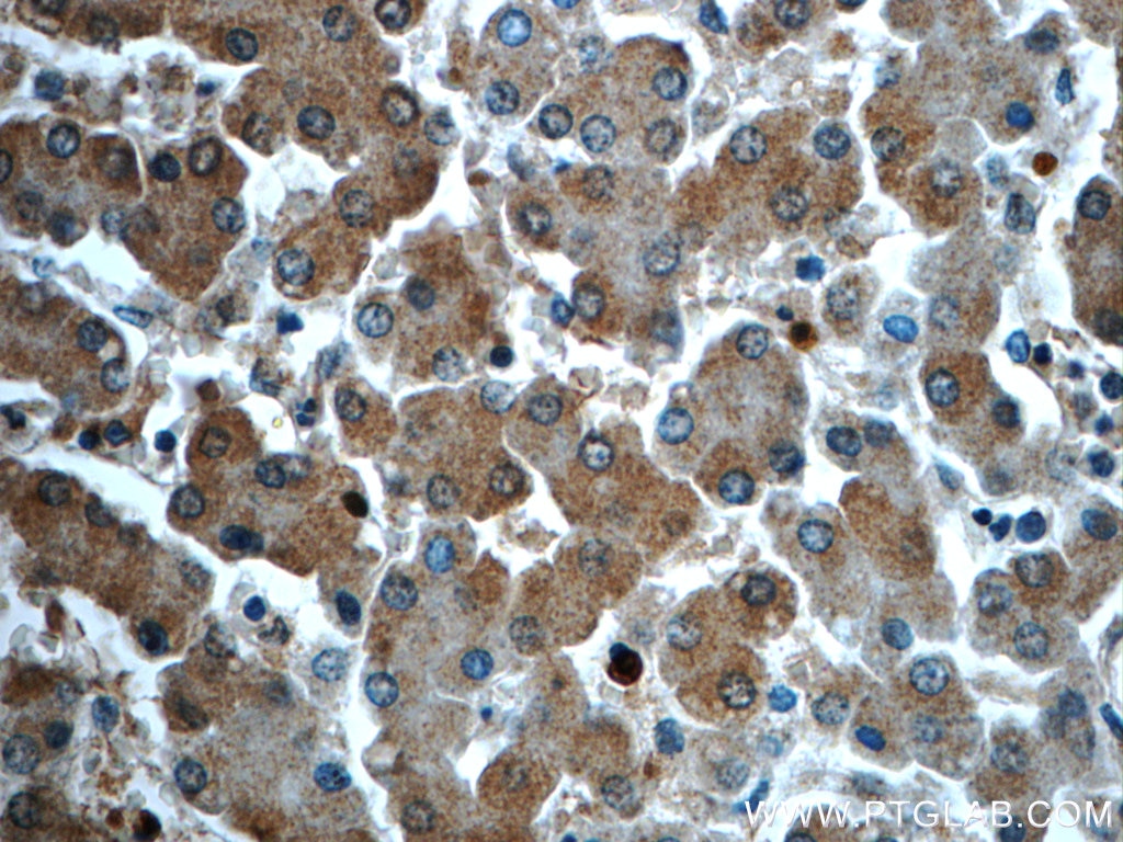 IHC staining of human liver using 24412-1-AP