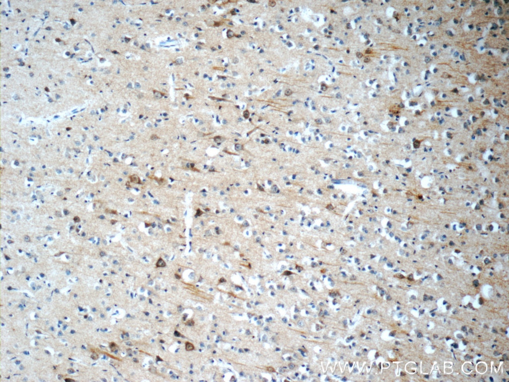 Immunohistochemistry (IHC) staining of human brain tissue using ATG14/Barkor (C-terminal) Polyclonal antibody (24412-1-AP)