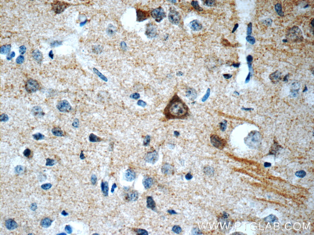 Immunohistochemistry (IHC) staining of human brain tissue using ATG14/Barkor (C-terminal) Polyclonal antibody (24412-1-AP)