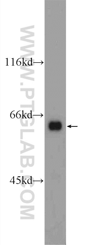 Western Blot (WB) analysis of mouse brain tissue using ATG14/Barkor (C-terminal) Polyclonal antibody (24412-1-AP)