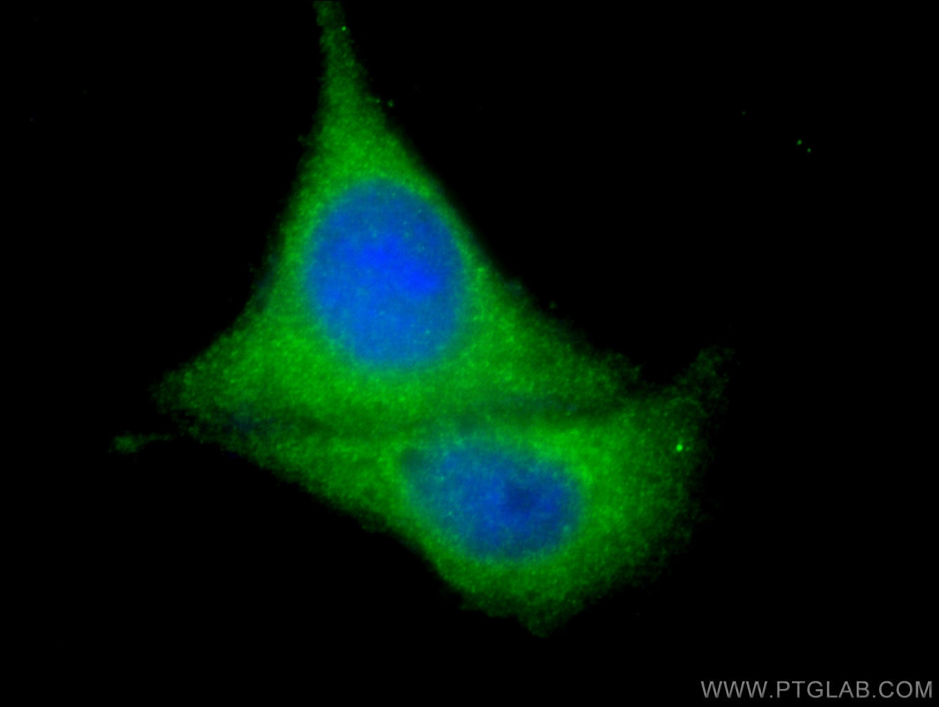 Immunofluorescence (IF) / fluorescent staining of MCF-7 cells using ATG14/Barkor (N-terminal) Polyclonal antibody (19491-1-AP)