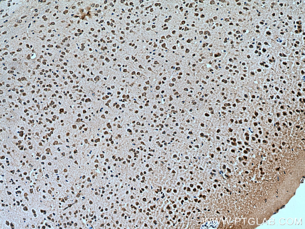 Immunohistochemistry (IHC) staining of mouse brain tissue using ATG14/Barkor (N-terminal) Polyclonal antibody (19491-1-AP)
