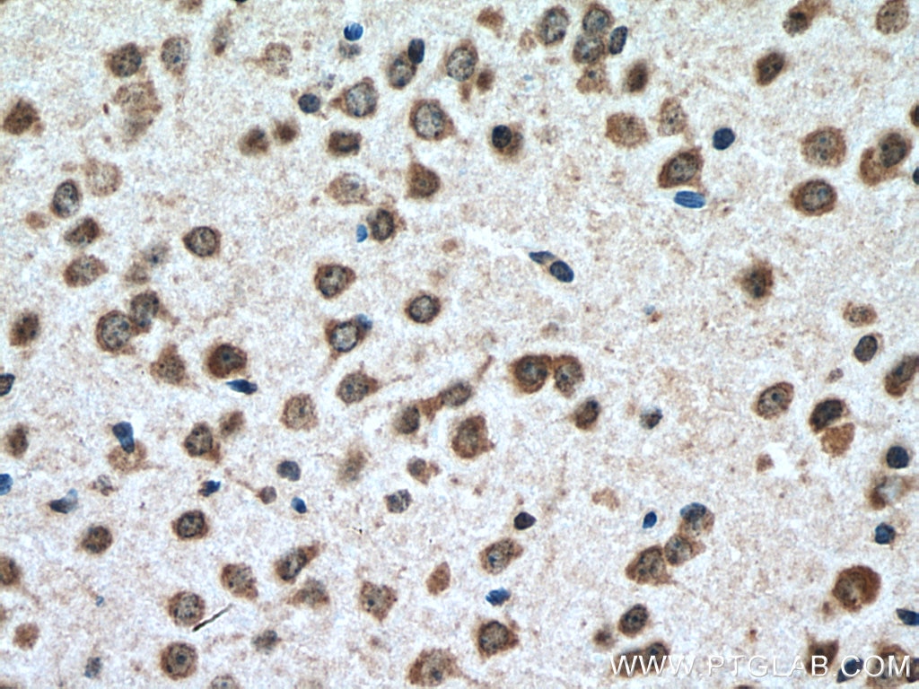 Immunohistochemistry (IHC) staining of mouse brain tissue using ATG14/Barkor (N-terminal) Polyclonal antibody (19491-1-AP)