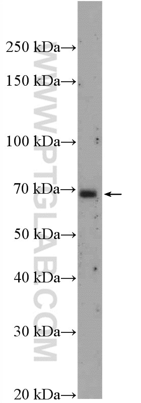 Western Blot (WB) analysis of A431 cells using ATG14/Barkor (N-terminal) Polyclonal antibody (19491-1-AP)