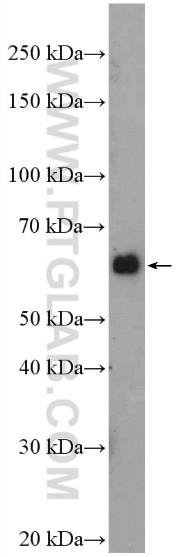 Western Blot (WB) analysis of HEK-293 cells using ATG14/Barkor (N-terminal) Polyclonal antibody (19491-1-AP)