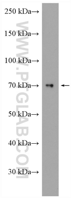 Western Blot (WB) analysis of mouse brain tissue using ATG14/Barkor (N-terminal) Polyclonal antibody (19491-1-AP)