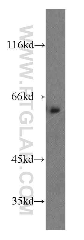 ATG14/Barkor (N-terminal) Polyclonal antibody