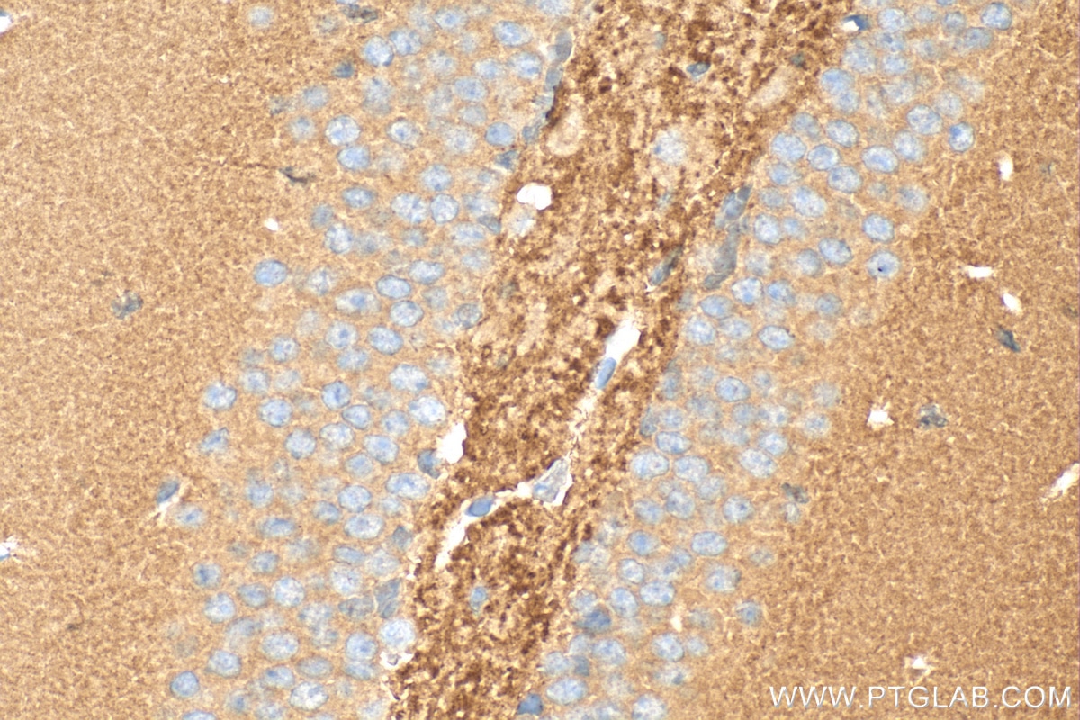 IHC staining of mouse brain using 30392-1-AP