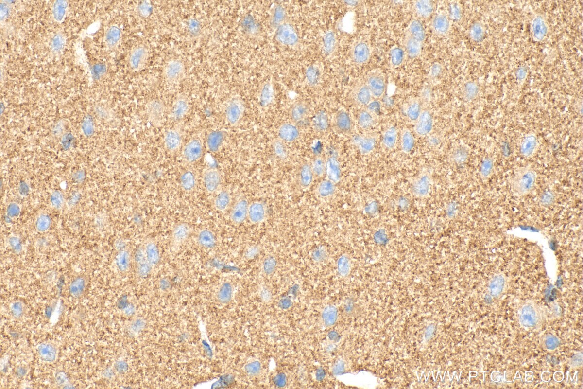 Immunohistochemistry (IHC) staining of mouse brain tissue using Bassoon Polyclonal antibody (30392-1-AP)